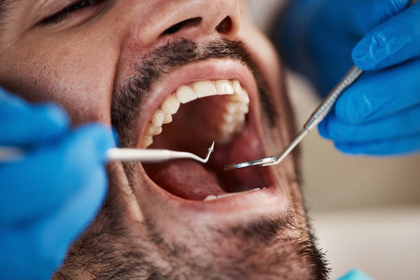 Best Broken or Chipped Tooth Repair in Price, UT